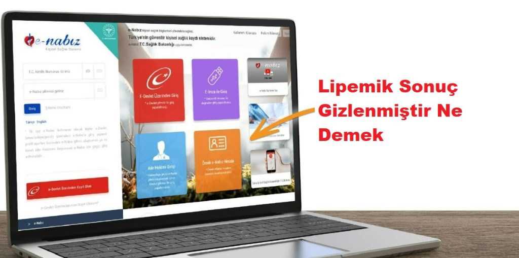 Lipemik Sonuç Gizlenmiştir Ne Demek