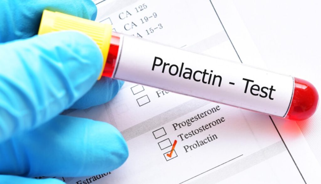 Prolaktin Yüksekliğinde Yenmemesi Gerekenler