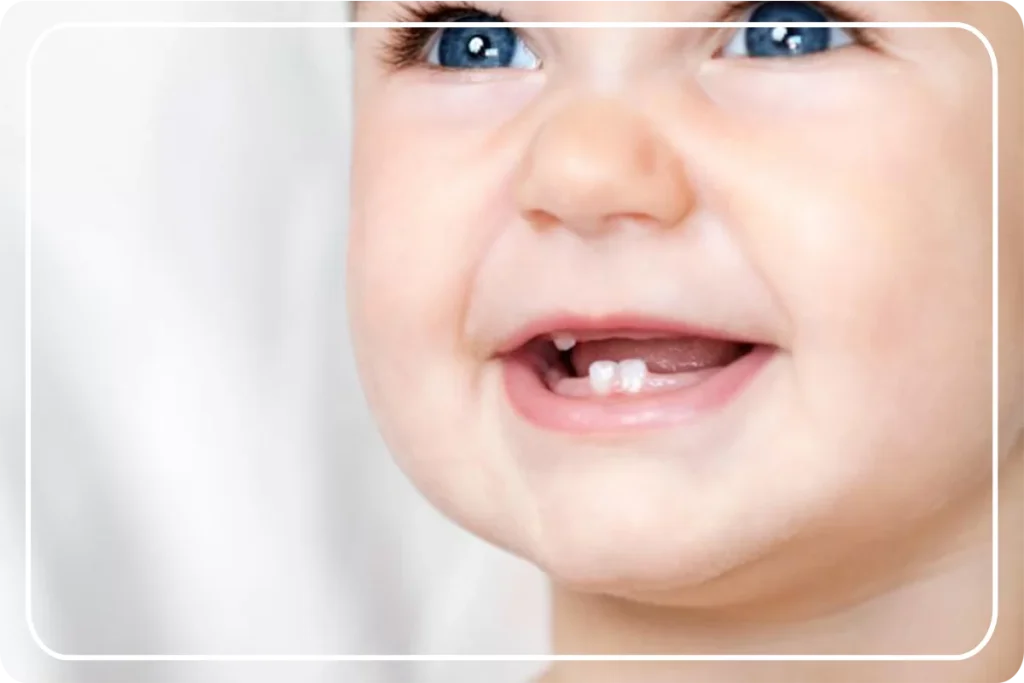 Bebeklerde Diş Ne Zaman Çıkar ?